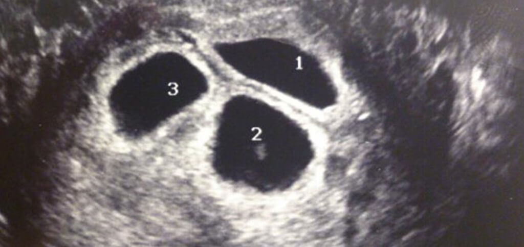 justice-family-adoption-surprise-16