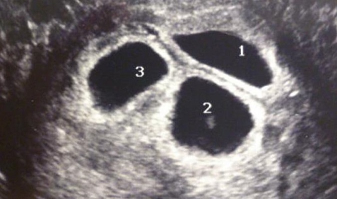 14 Padres Trillizos 16