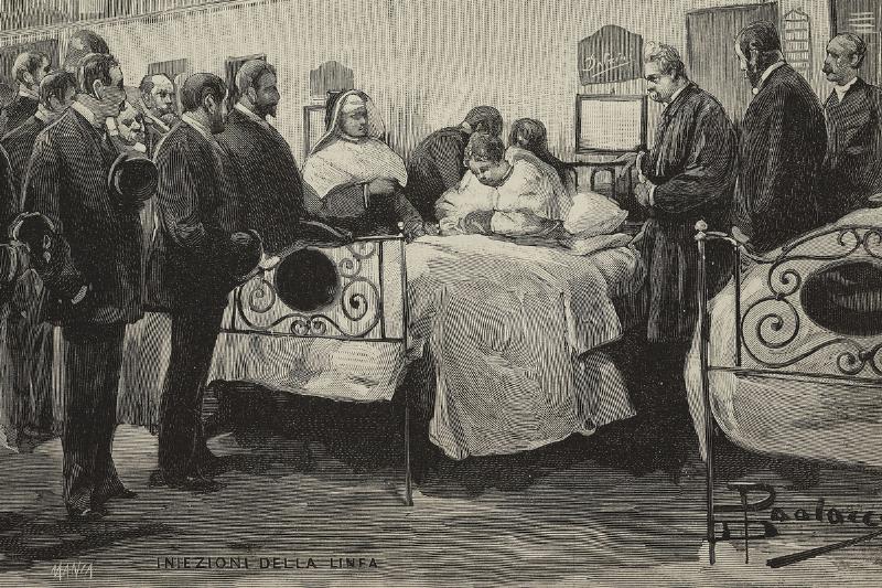 tuberculosis - 1095414070 Experiments using Robert Koch's lymph method being done by Dr Baccelli on a tuberculosis patient at the Santo Spirito hospital, Rome, Italy, engraving by Manza from a drawing by Dante Paolocci, 1890