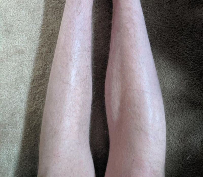left leg and right leg for comparison