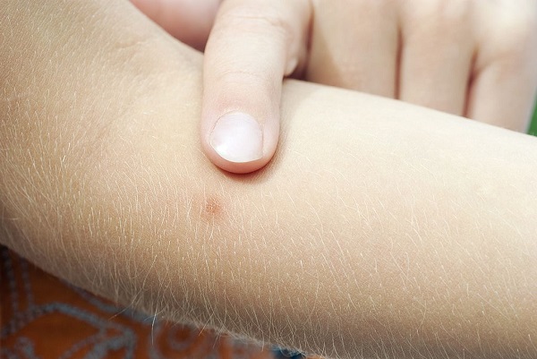 19 Bicarbonato de Sodio 1