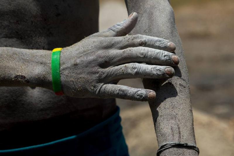 Man touching his skin 