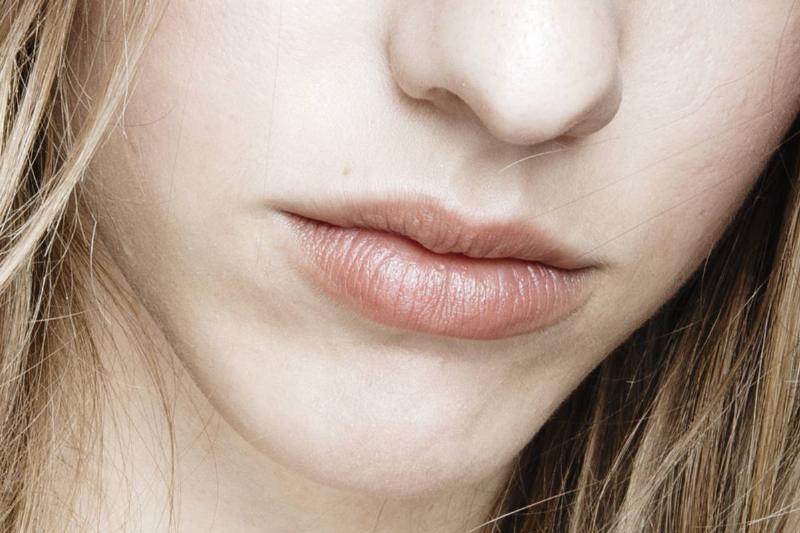 chapped lips - 1000341022 A close-up shows a model's lips.