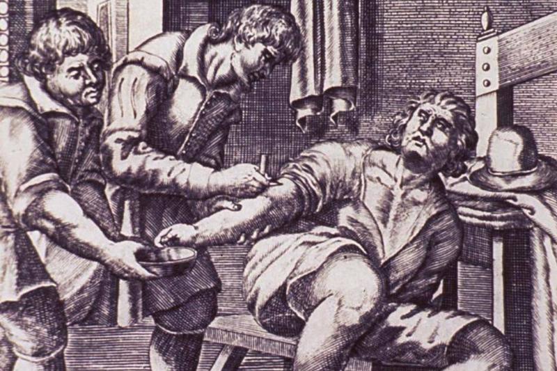 Bloodletting Was Thought To Cure Anything Bloodletting Was Thought To Cure Anything