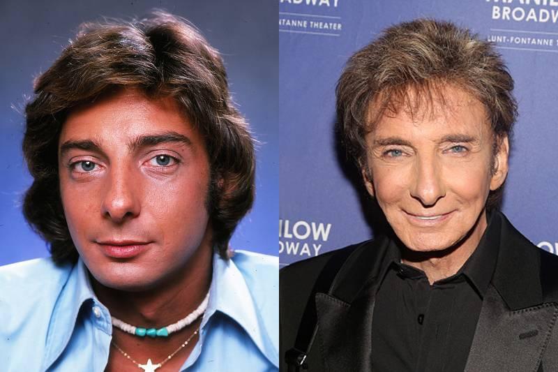 barry-manilow-plastic-surgery