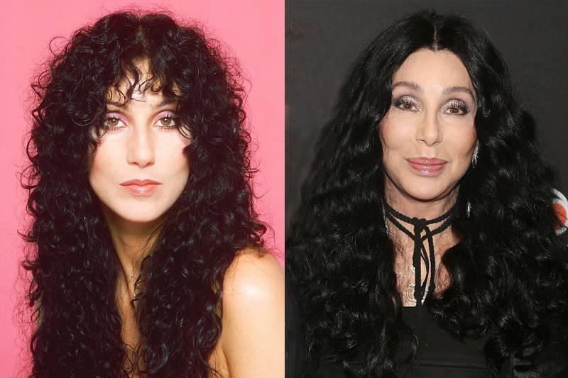 cher-plastic-surgery