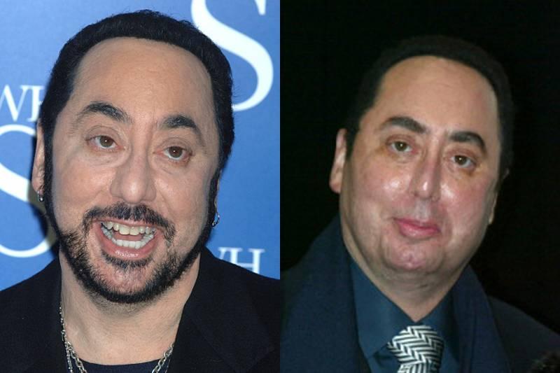 david-gest-plastic-surgery