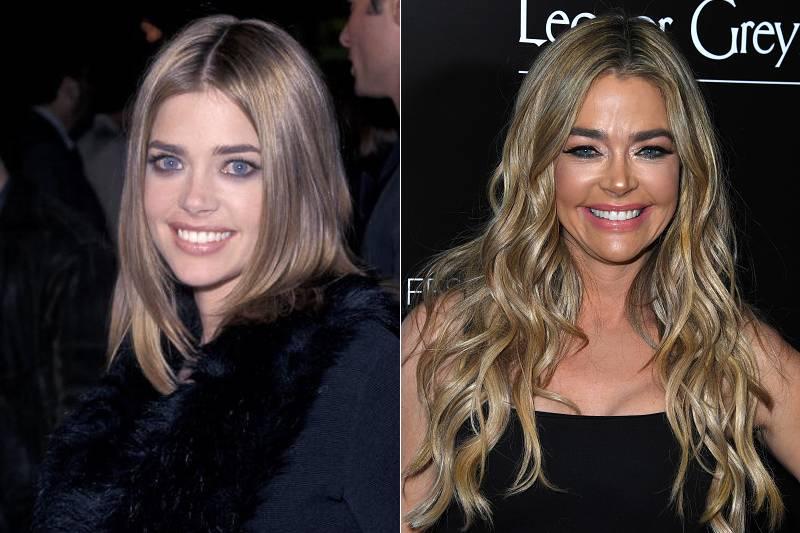 denise-richards-plastic-surgery