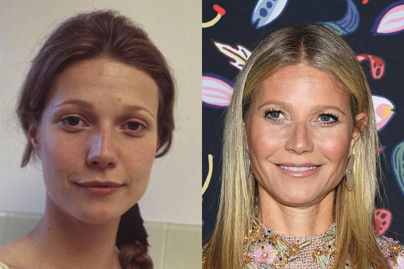 gweneth-paltrow-plastic-surgery