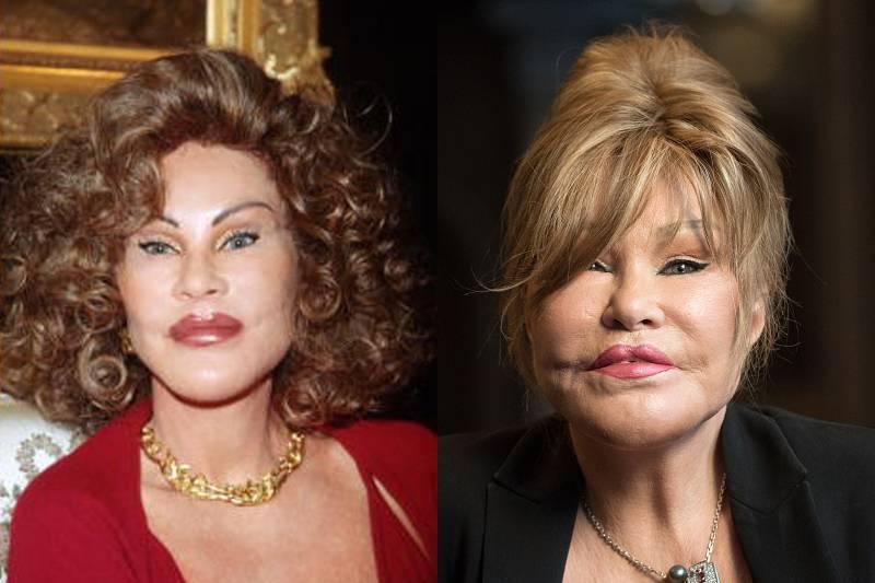 jocelyn-wildenstein-plastic-surgery