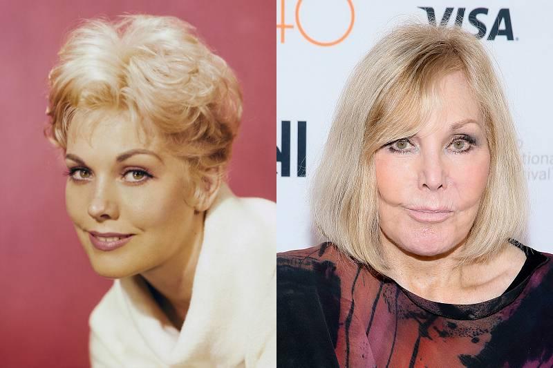 kim-novak-plastic-surgery