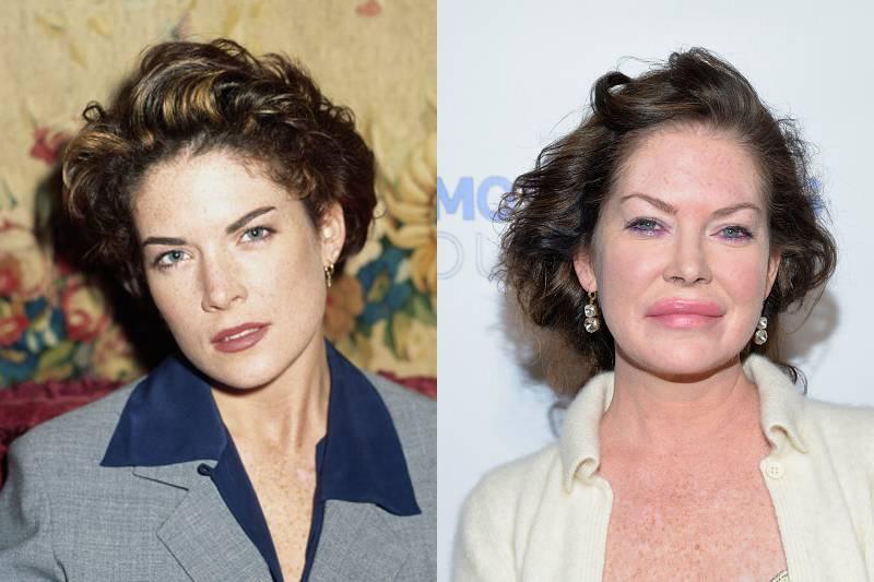 lara-flynn-boyle-plastic-surgery