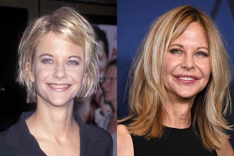 meg-ryan-plastic-surgery