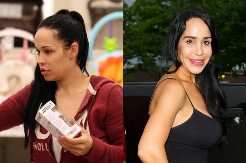 nadya-suleman-plastic-surgery