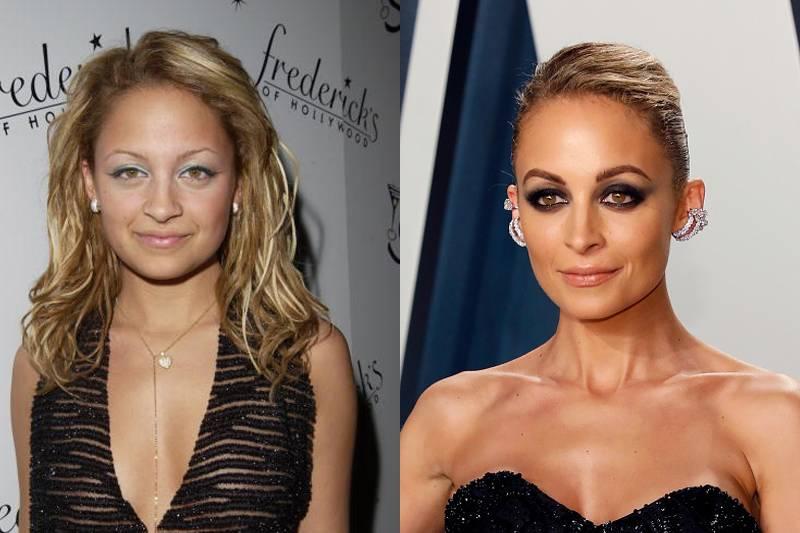 nicole-richie-plastic-surgery
