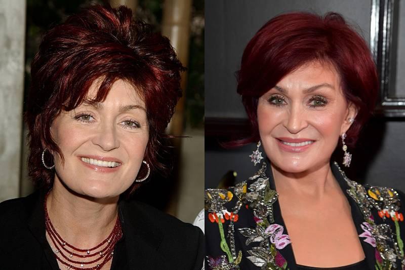 sharon-osbourne-plastic-surgery