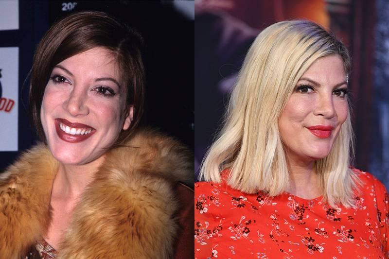 tori-spelling-plsatic-surgery
