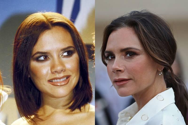 victoria-beckham-plastic-surgery