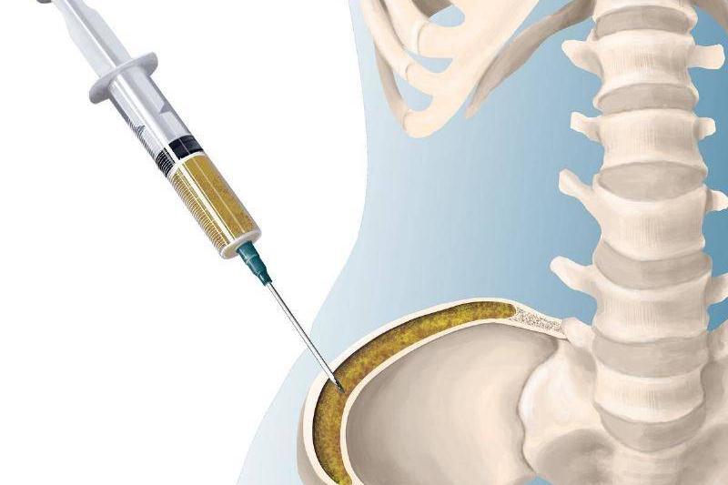 04 Renovacion Padre Trillizos 34