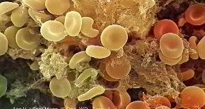 Things That Your Blood Type Reveals About You, According To Science