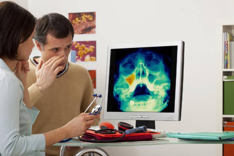 Sinusitis In A Man