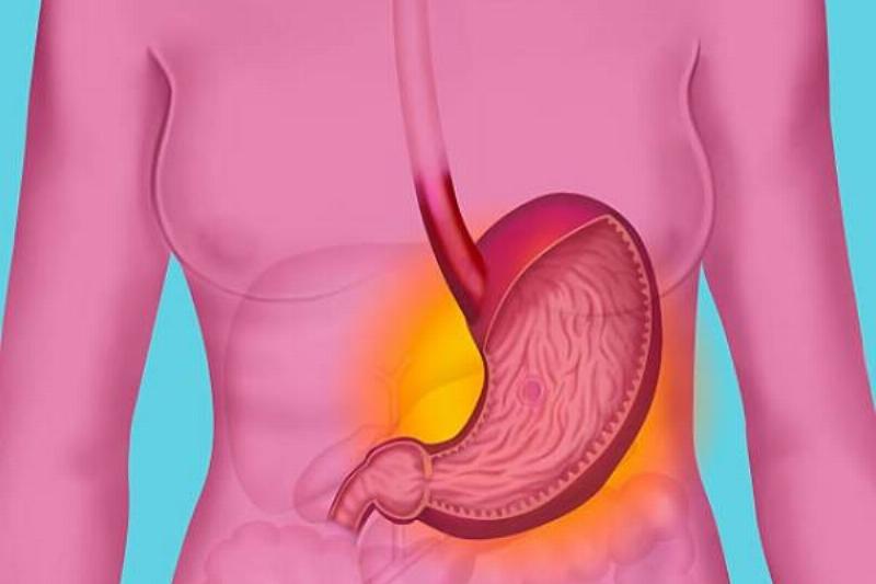 2 Flor de Jamaica 11 2 Flor de Jamaica 11