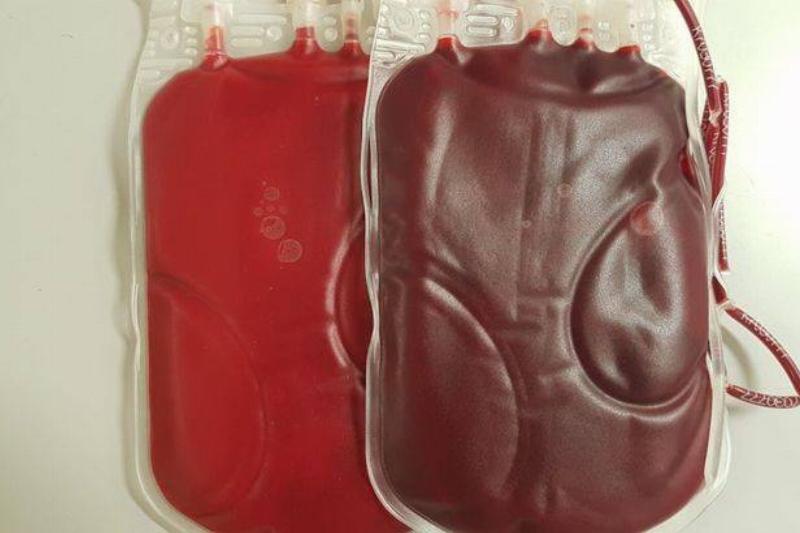 smoking blood vs non smoking blood