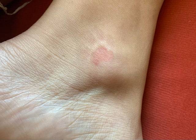 pawprint paw imprint on ankle