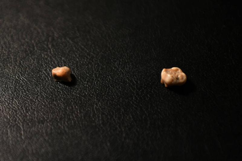 human and neanderthal tooth
