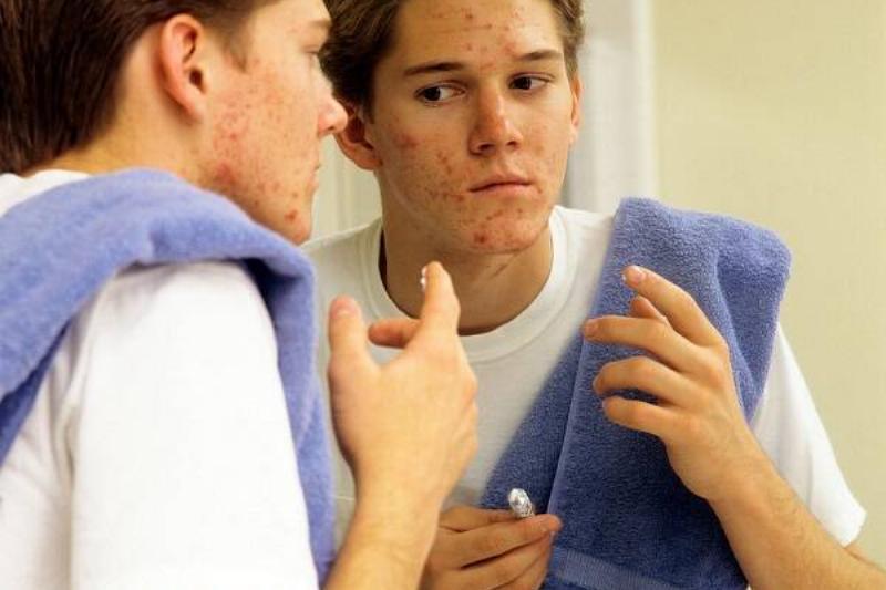 06 Aloe Vera 17 06 Aloe Vera 17