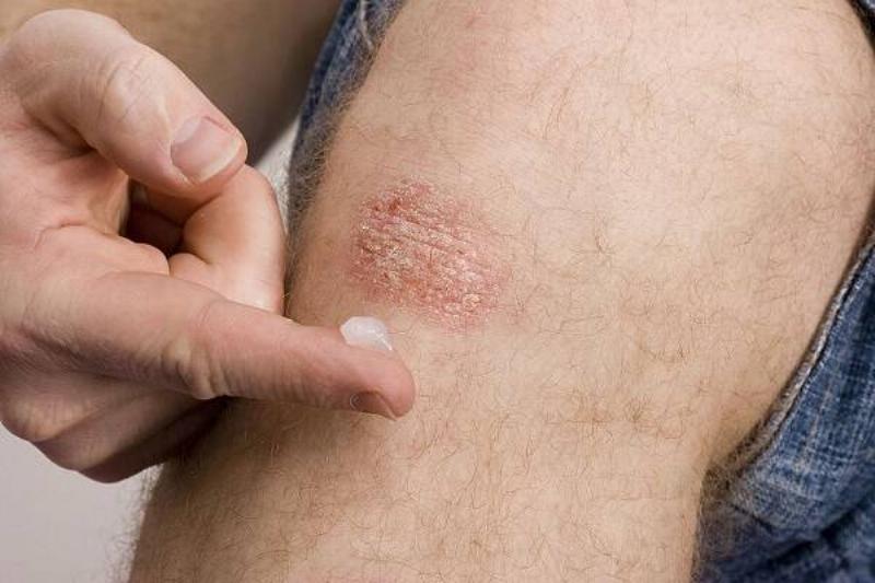 06 Aloe Vera 7 06 Aloe Vera 7