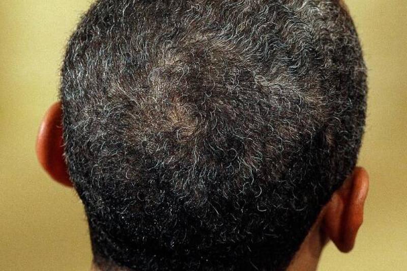 06 Aloe Vera 8 06 Aloe Vera 8