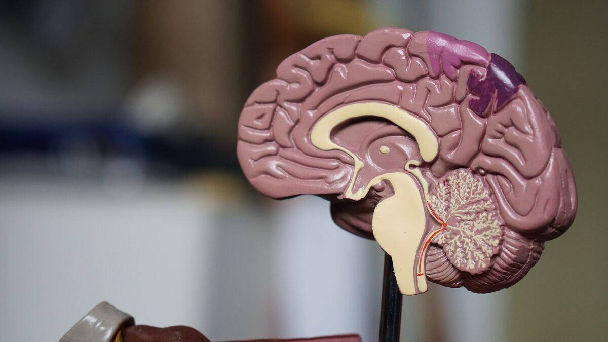 diagram of half a brain