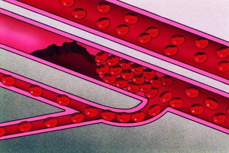 09 Hierba Ruda 5 09 Hierba Ruda 5