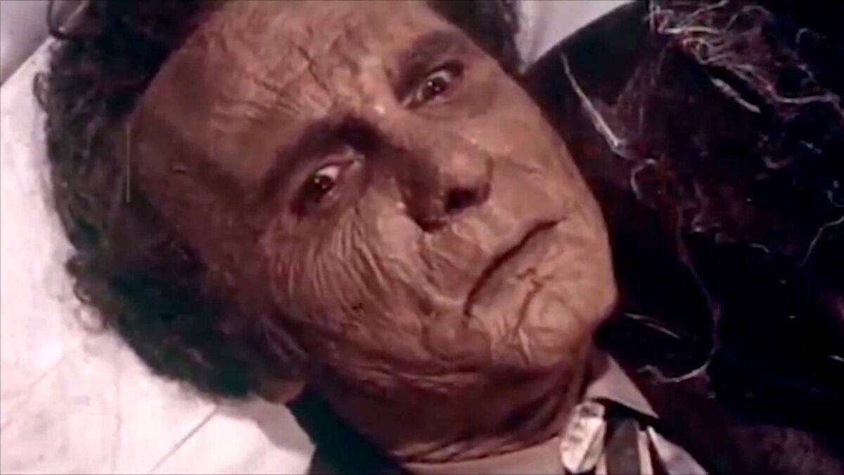 man with wrinkled skin