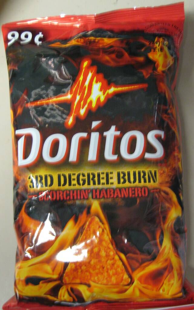a bag of doritos 3rd degree burn