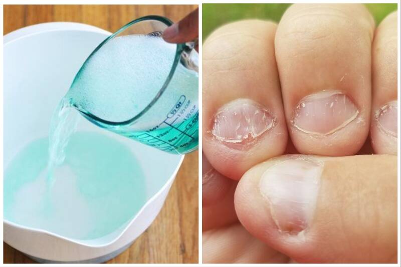 Mouthwash hacks
