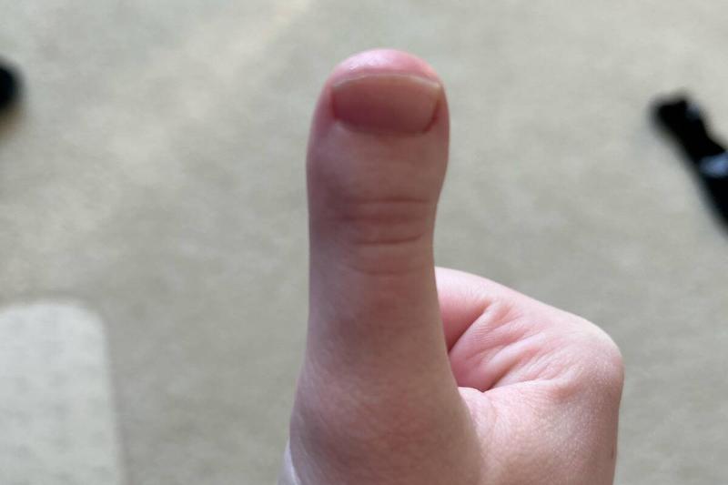 thumb
