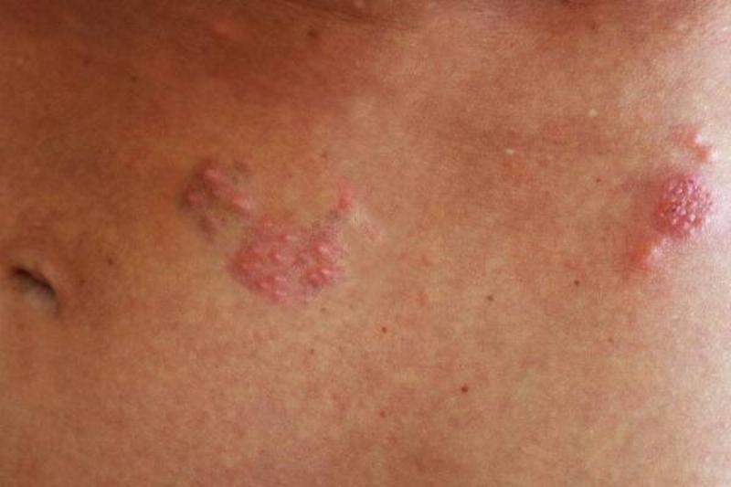 12 Renov Aloe Vera 25 12 Renov Aloe Vera 25