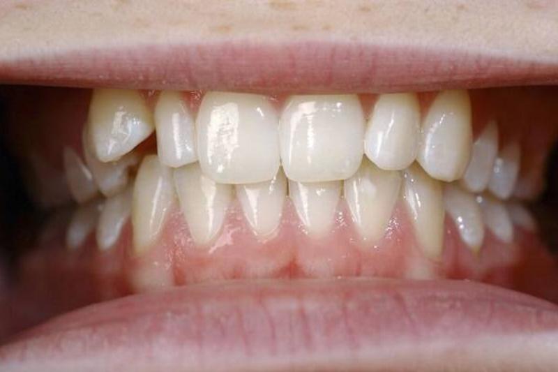 12 Renov Aloe Vera 34 12 Renov Aloe Vera 34