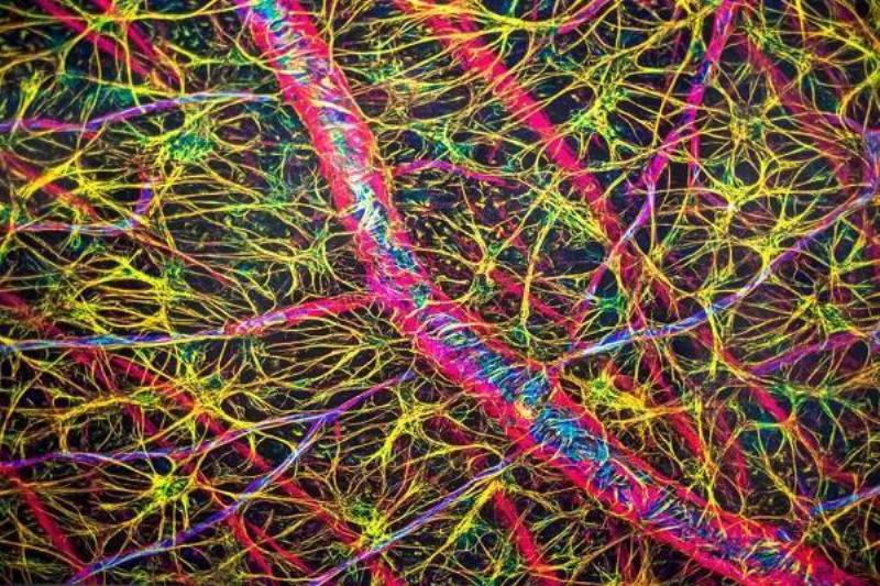 10 Renov Te Verde 25 10 Renov Te Verde 25