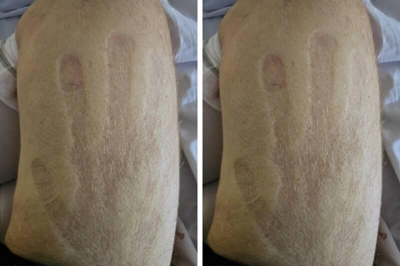 handprint2