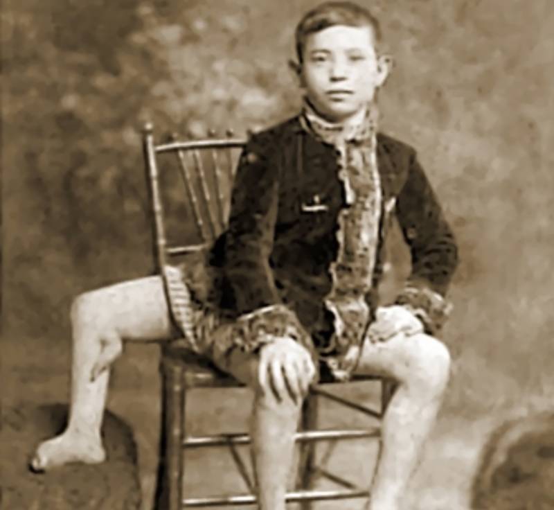 franklentinizusatzfussretouched-1