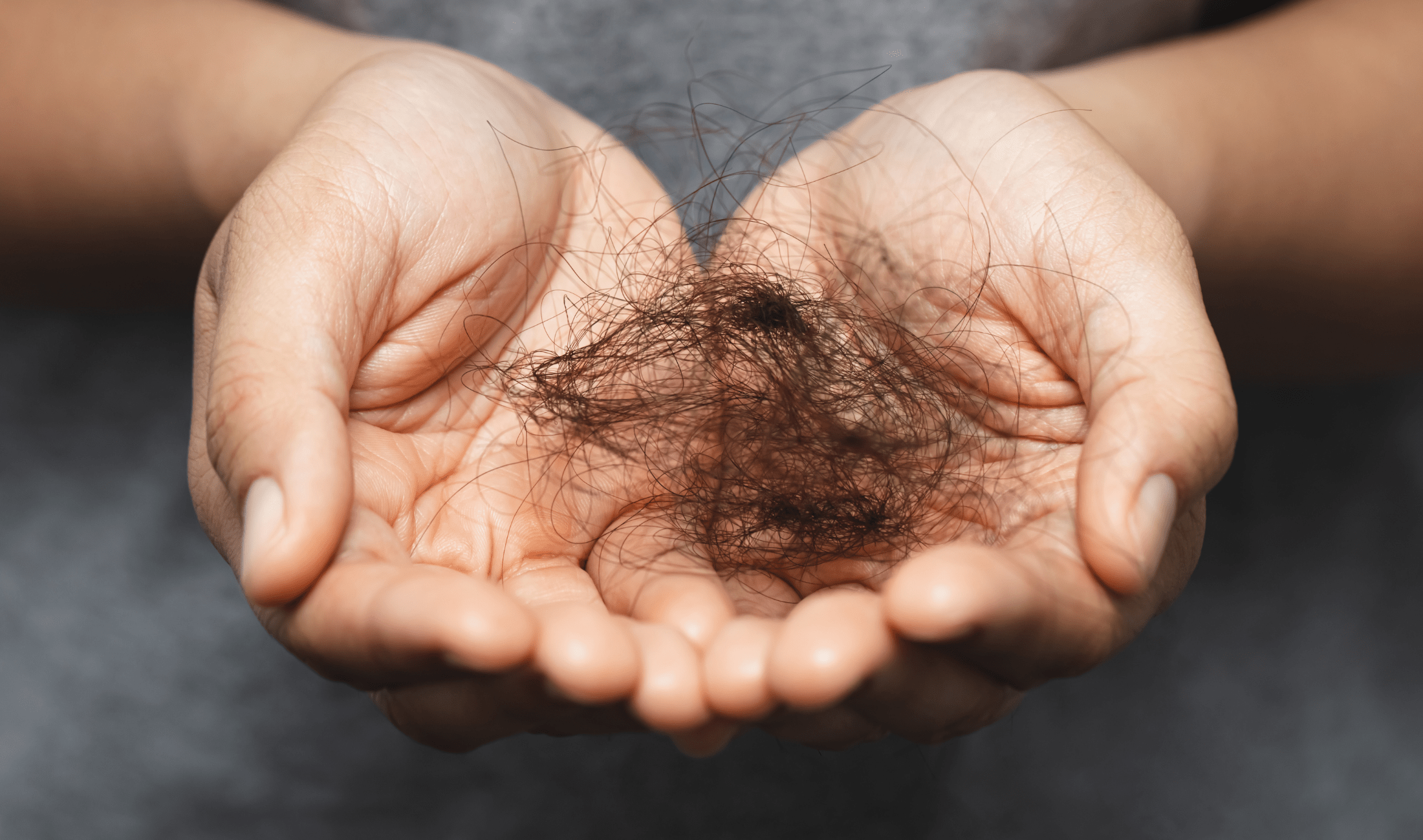 Two cupped hands holding hair that had fallen out.